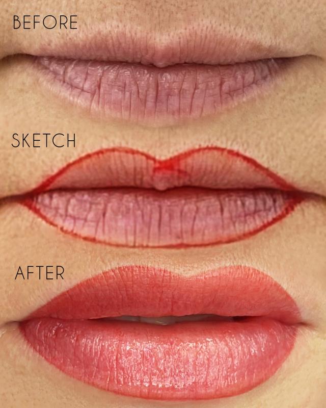 Лазерное удаление татуировок и татуажа