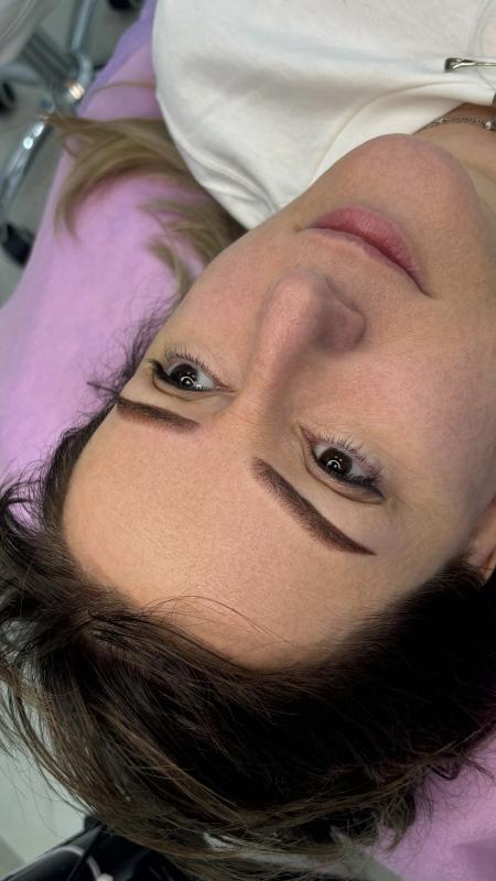 Лазерное удаление татуировок и татуажа