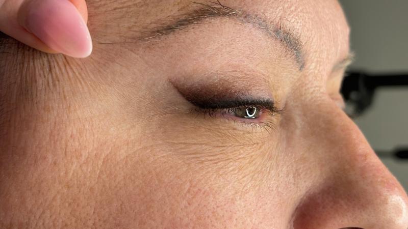 Лазерное удаление татуировок и татуажа