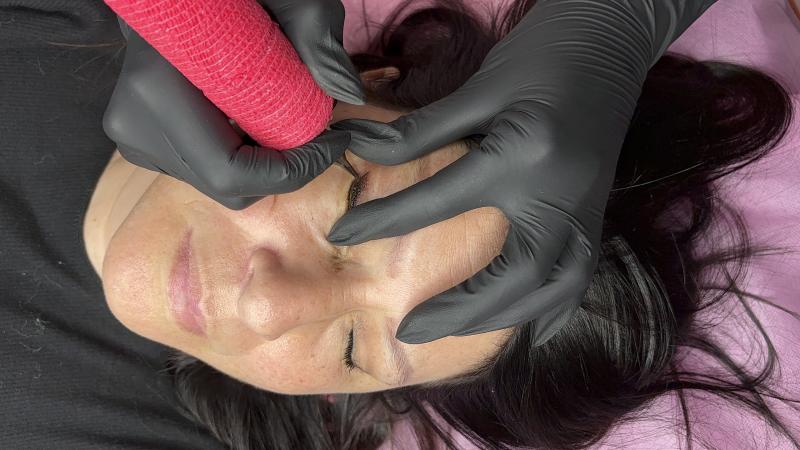 Лазерное удаление татуировок и татуажа