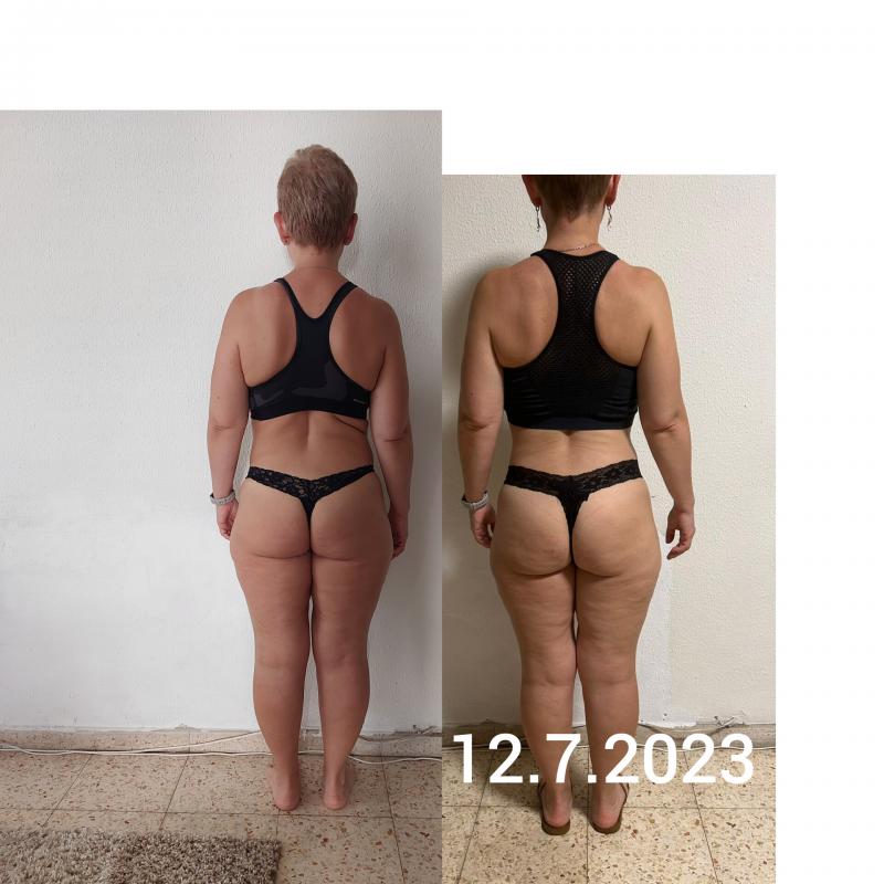 Прессо терапия, ручная липосакция, антицеллюлитный  массаж