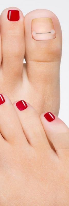 Ногтевой сервис, маникюр, педикюр, медицинский педикюр.