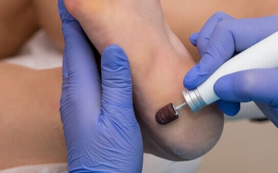 Лечение ногтей:Коррекция вросших ногтей, Терапия грибковых заболеваний