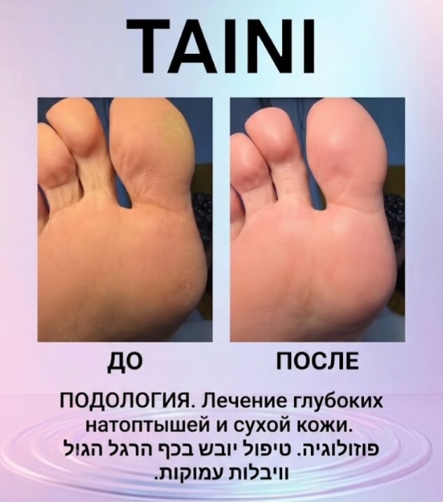 Медицинский Педикюр, Подолог в Петах-Тикве! פדיקור רפואי ומניקור בפתח
